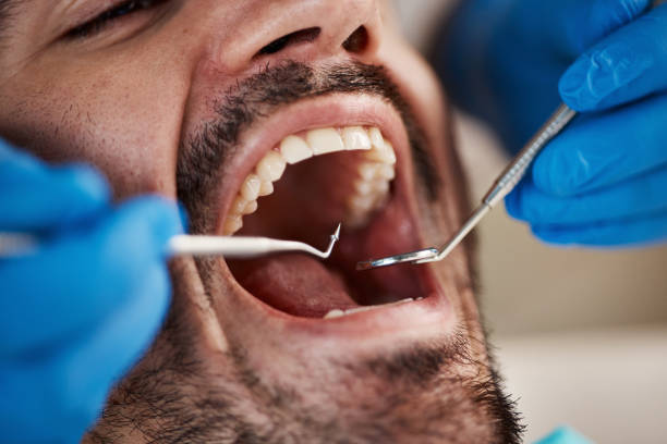 Best Emergency Gum Treatment in West Wood, UT