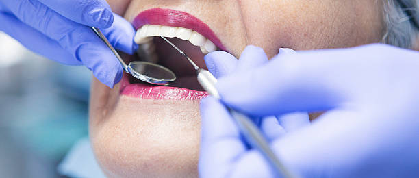 Best Emergency Dental Care for Broken or Chipped Teeth in West Wood, UT